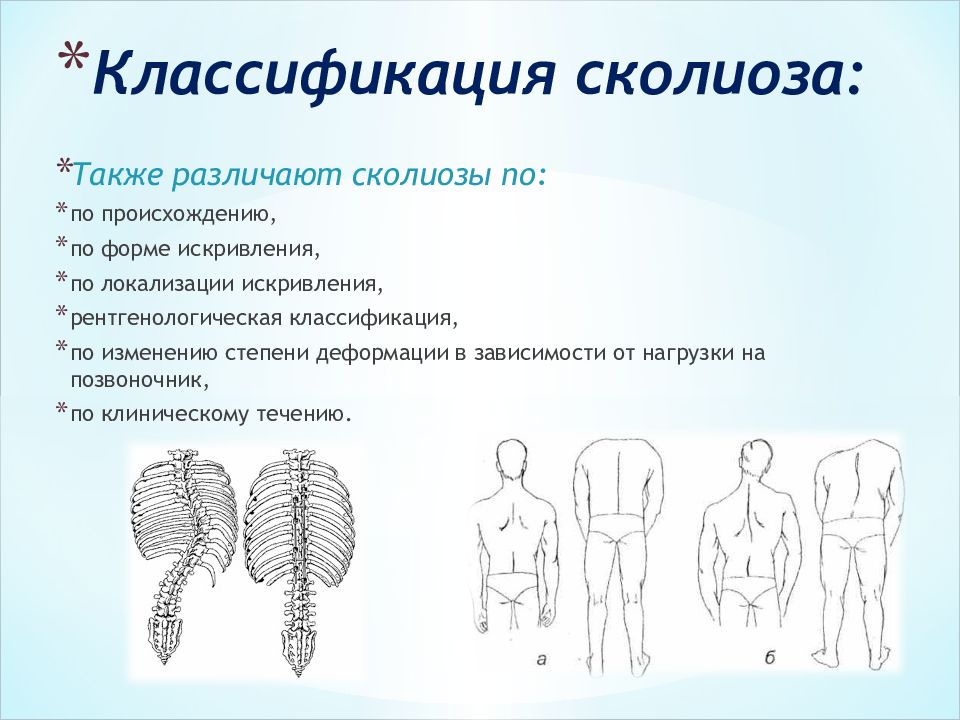 Сколиоз картинки для презентации