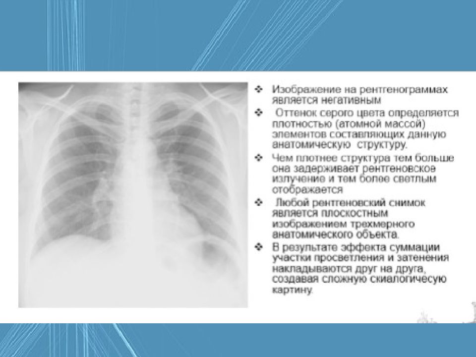 Методы лучевой диагностики органов дыхания презентация