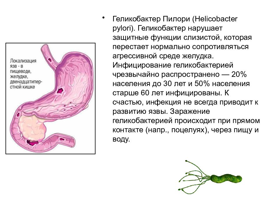 Причины появления бактерий в желудке. Хеликобактер пилори функции. Симптомы болезни желудка хеликобактер. Бактерия хеликобактер пилори схема. Хеликобактер пилори в желудке.
