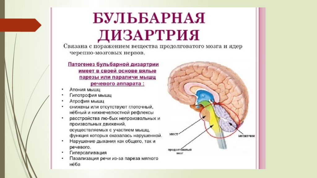 Дизартрия возникает при поражении. Классификация дизартрии по локализации. Бульбарная форма дизартрии. Дизартрия локализация поражения. Псевдобульбарная дизартрия очаг поражения мозга.