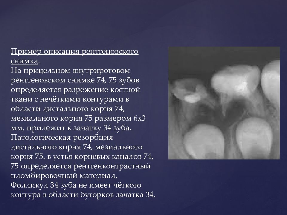 Пример описания рентгенограммы