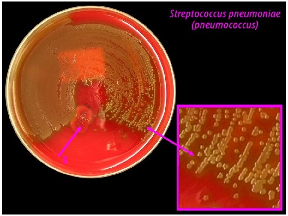 Пневмококки микробиология презентация