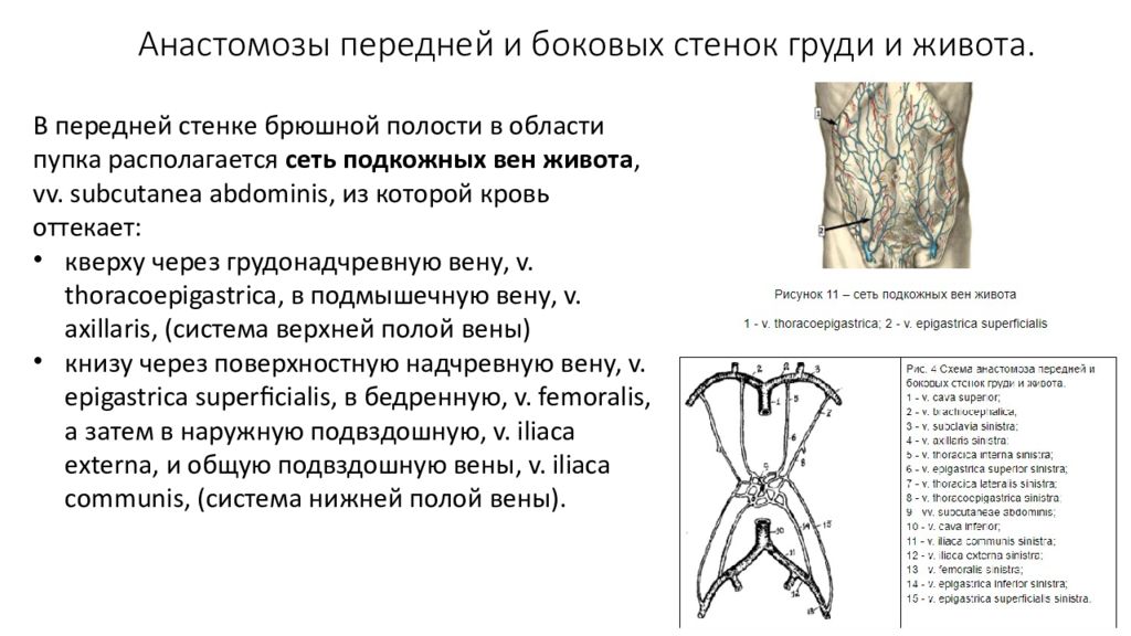 Анастомозы передней брюшной стенки. Анастомозы вен портокавальные. Анастомозы вены кава кавальные. Схема формирования позвоночного венозного анастомоза.