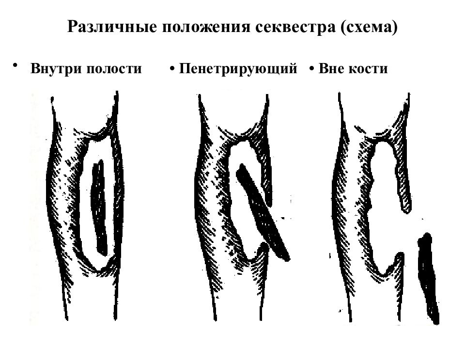 Внешние Признаки Девственницы