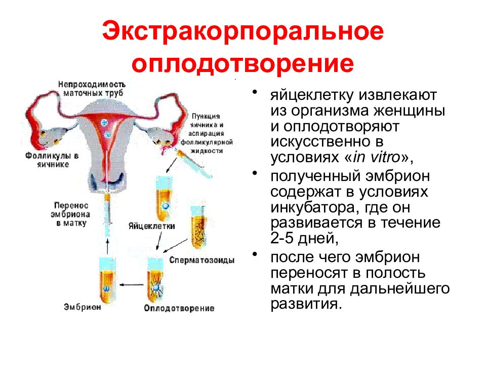 Женщины доноры яйцеклеток. Оплодотворение. Оплодотворение в маточной трубе. Искусственная инсеминация. Экстракорпоральное оплодотворение.