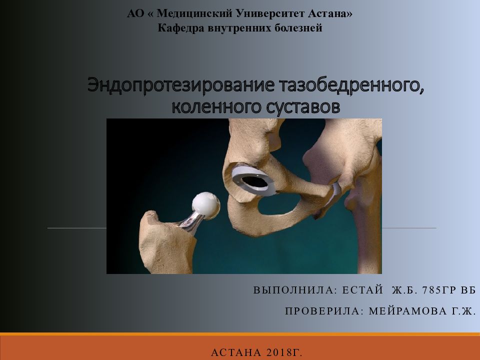 Эндопротезирование тазобедренного, коленного суставов
