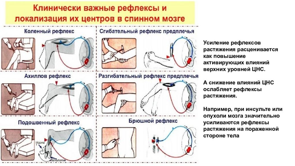 Схема рефлекса растяжения