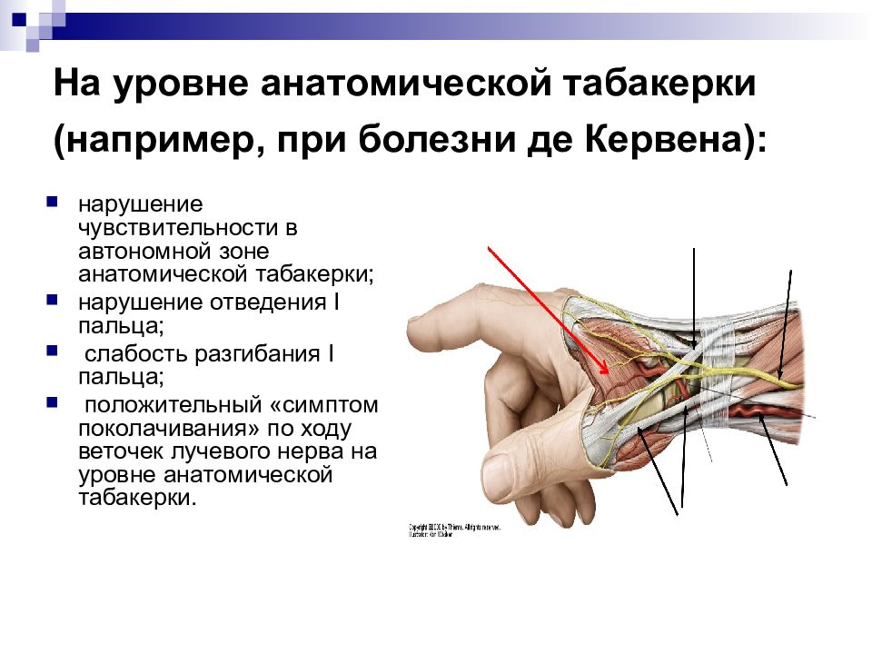 Болезнь суставов де кервена. Лучевой локтевой и срединный нервы. Невропатия лучевого локтевого и срединного нервов. Проекционные линии срединного нерва, лучевой и локтевой артерий. Локтевой нерв уровни поражения.