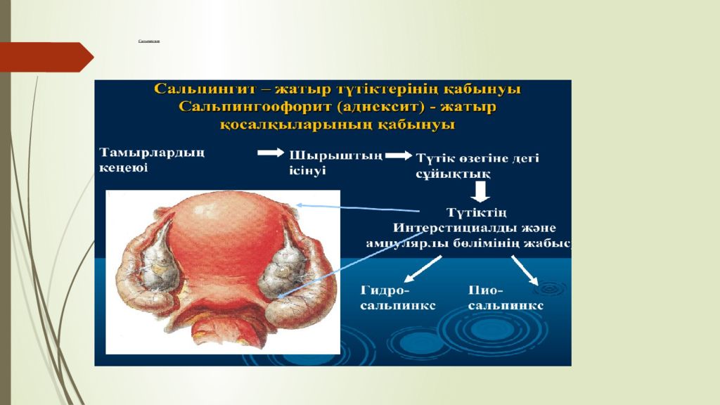 Сальпингит это