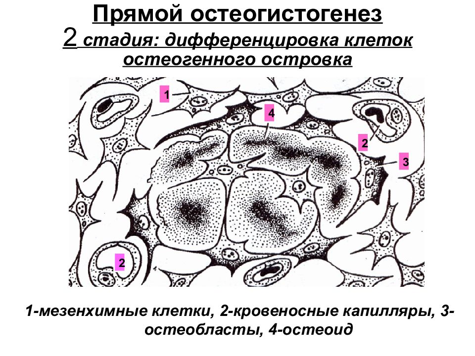 Стадия 2 клеток. Прямой остеогистогенез. Прямой остеогистогенез препарат. Прямой остеогистогенез этапы. Образование скелетогенного островка.