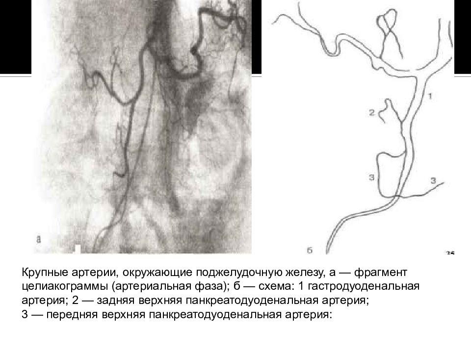 Лучевая диагностика печени и желчевыводящих путей презентация