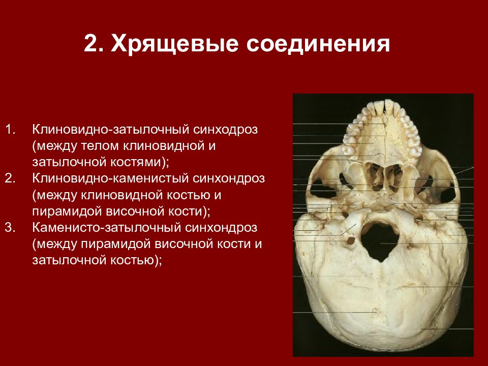 Соединения между затылочной костью. Клиновидно-Каменистый синхондроз на черепе. Синхондрозы черепа анатомия. Затылочная и клиновидная кости черепа соединены.