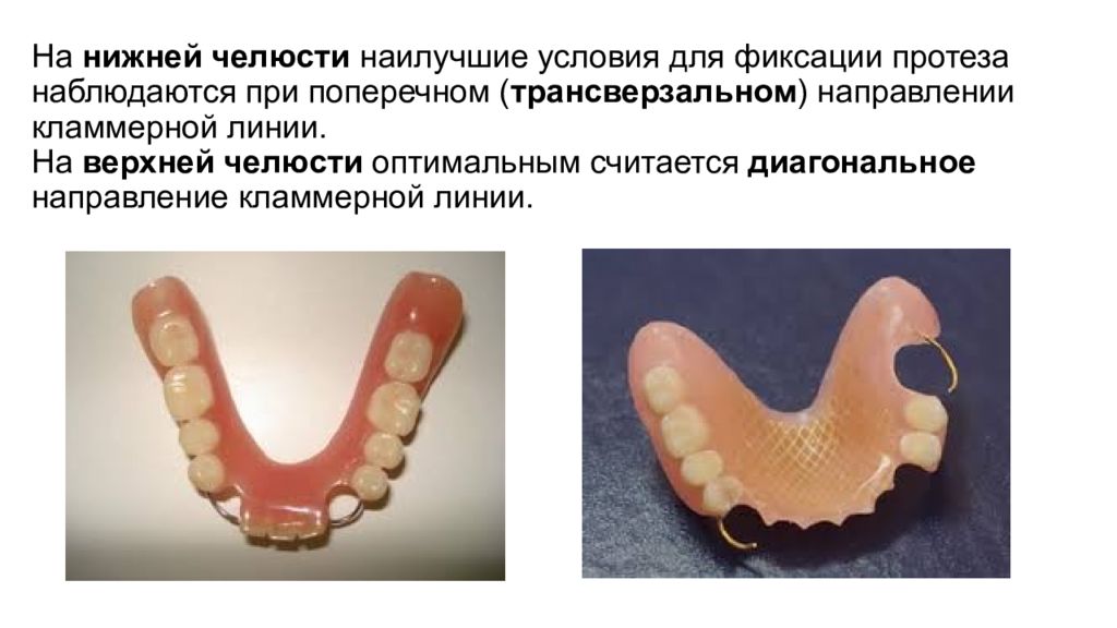 Чспп ортопедическая стоматология презентация