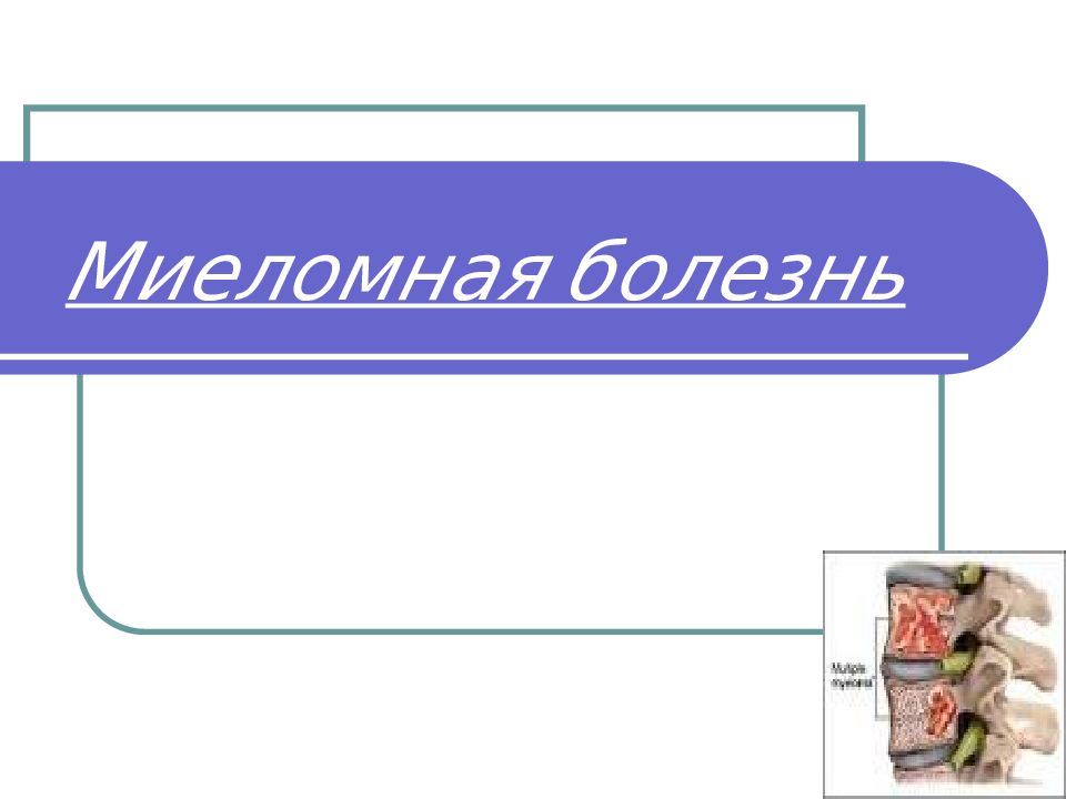 Презентация на тему миеломная болезнь