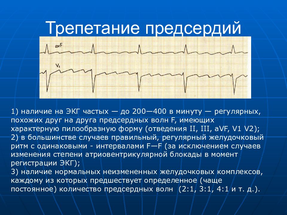 Презентация на тему экг