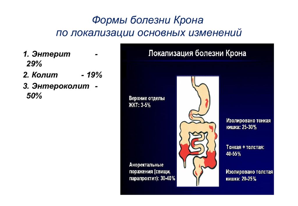 Внекишечное пищеварение. Болезнь крона презентация. Заболевания кишечника презентация.