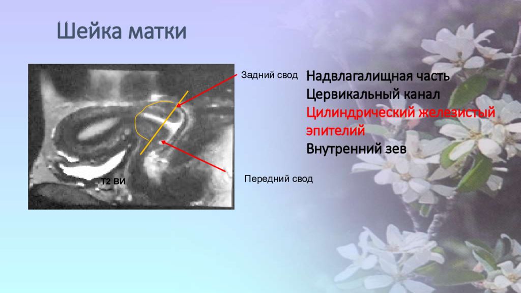 Задняя матка. Задний свод шейки матки. Передний свод и задний свод матки. Надвлагалищная часть шейки матки анатомия. Задний свод шейки матки цервикальный канал.