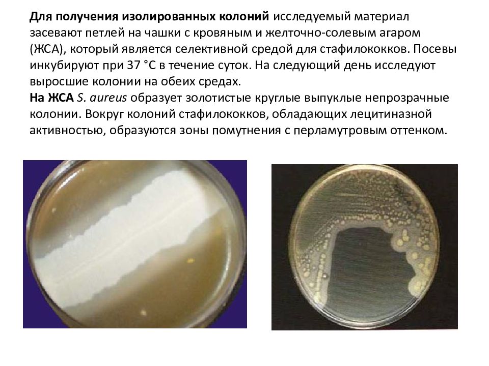 Желточно солевой агар