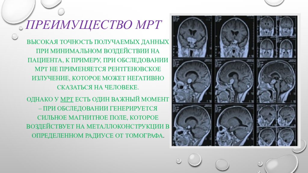 Кто придумал мрт