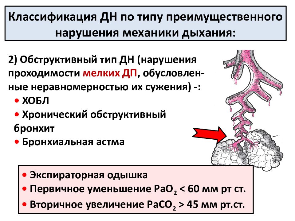 Обструктивное нарушение бронхиальной проходимости. Обструктивный Тип дыхательной недостаточности. Обструктивный Тип нарушения дыхания. Экспираторный коллапс бронхов. Патогенез одышки при дыхательной недостаточности.