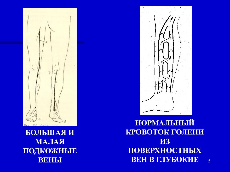 Варикоз корнилова схема