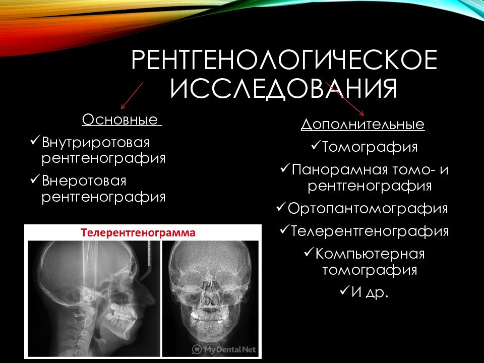 Рентгенография в стоматологии презентация