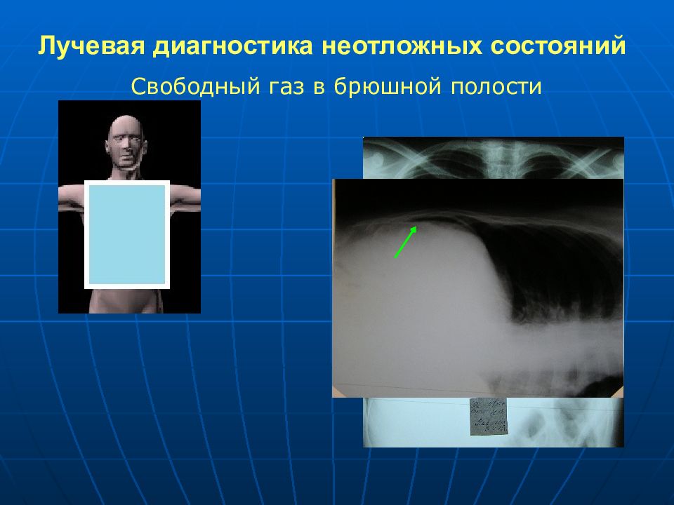 Неотложная рентгенодиагностика в неонатологии и педиатрии атлас рентгеновских изображений