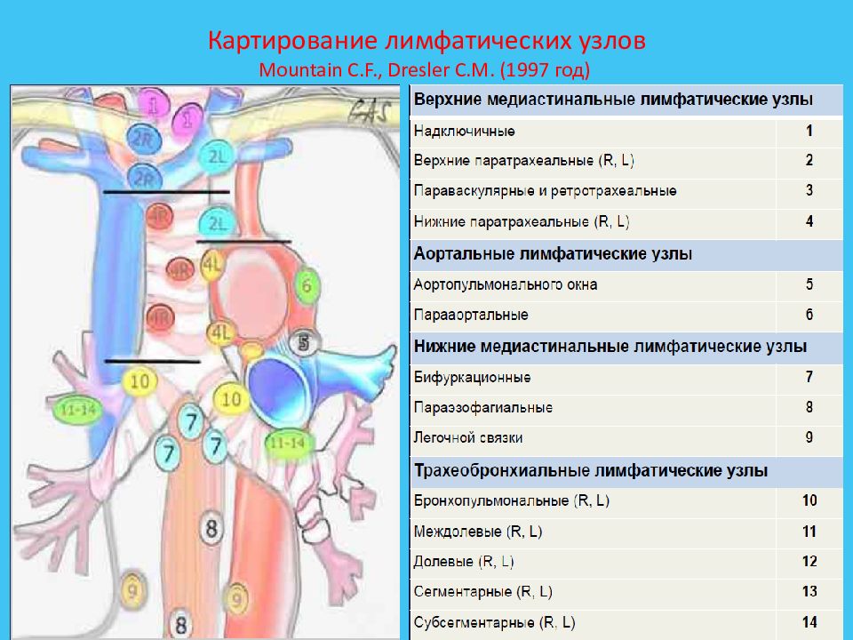 Лимфоузлы легких схема