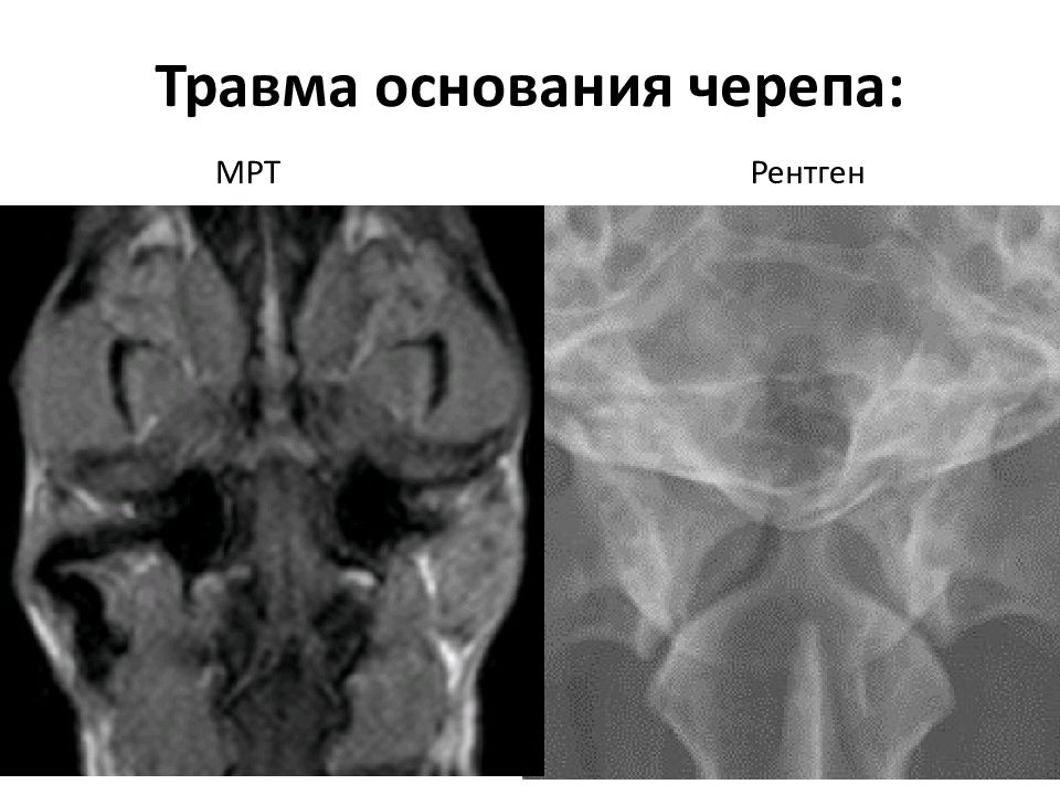 Компьютерная томография в неврологии презентация