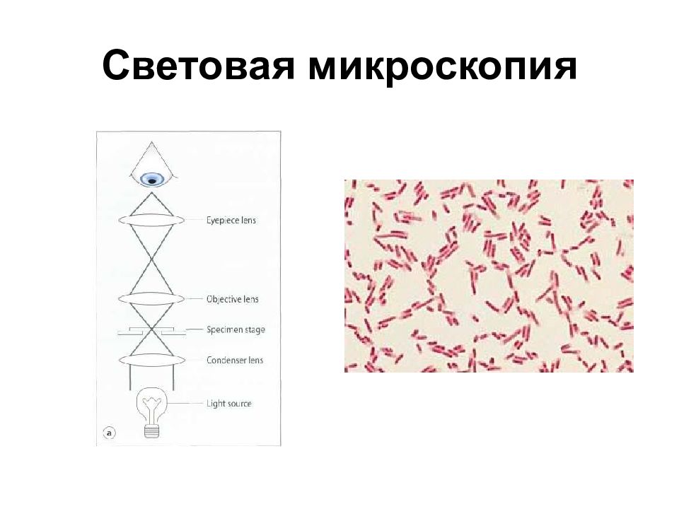 Световая микроскопия. Световой микроскоп микробиология. Световые микроскоппич. Световая микроскопия микробиология.