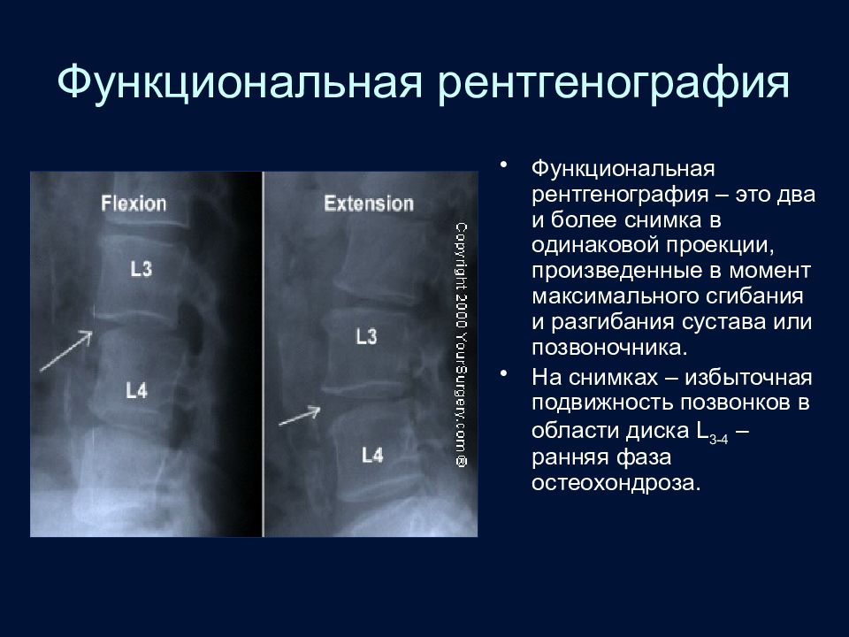 Укладки в рентгенологии в картинках и с описанием