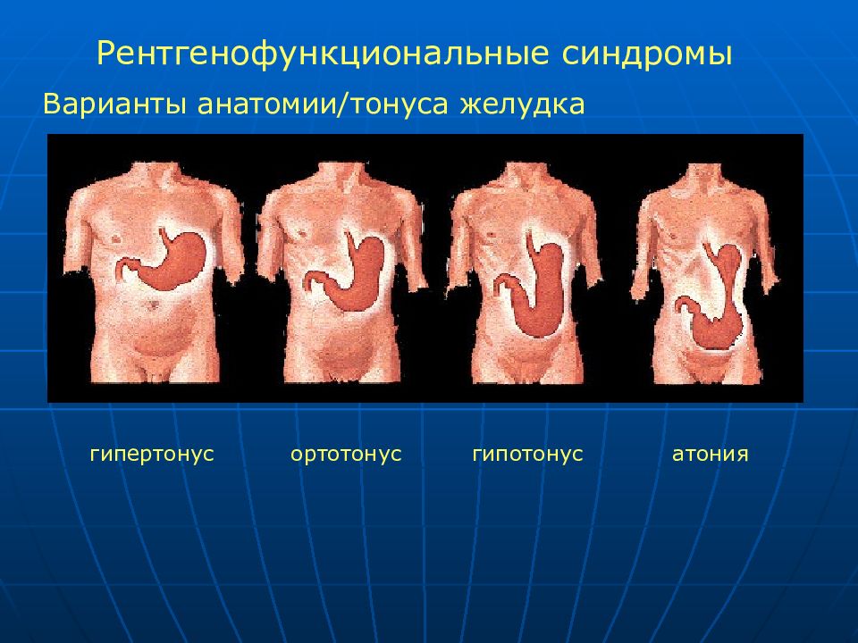 Атония жкт. Гипертонус ЖКТ. Повышение тонуса желудка.