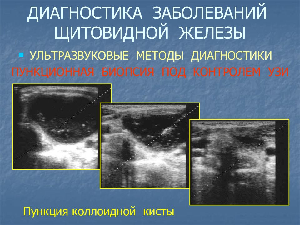 Диагностика заболеваний щитовидной железы презентация