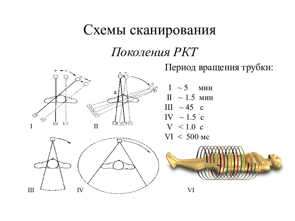 Схема кт. Рентгеновская компьютерная томография физика. Рентгеновская томография физика. РКТ физика.