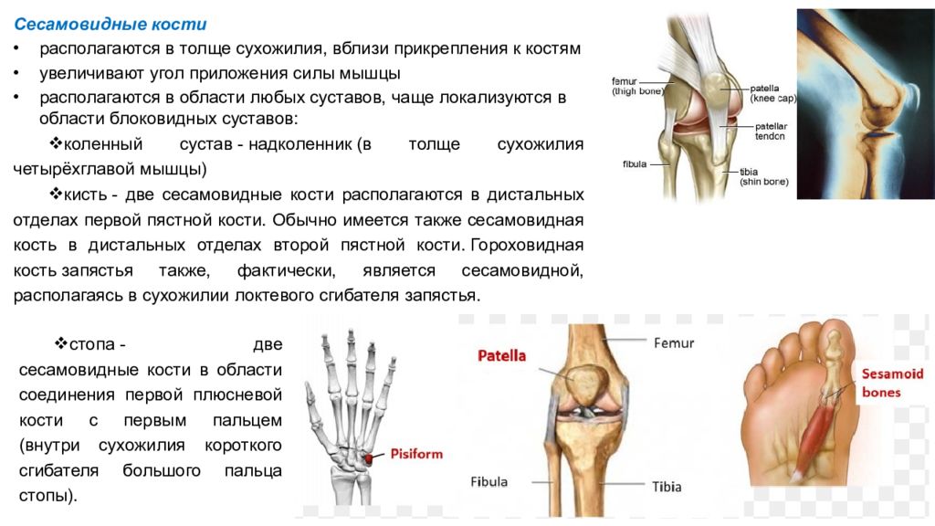 Сесамовидные кости. Сесамовидные кости 1 пястной кости. Сесамовидные кости 1 плюсневой кости. Сесамовидные кости большого пальца стопы. Сесамовидная кость межфалангового сустава.