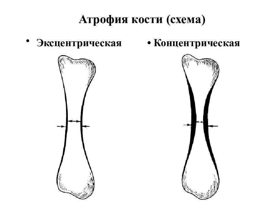 Схема костя