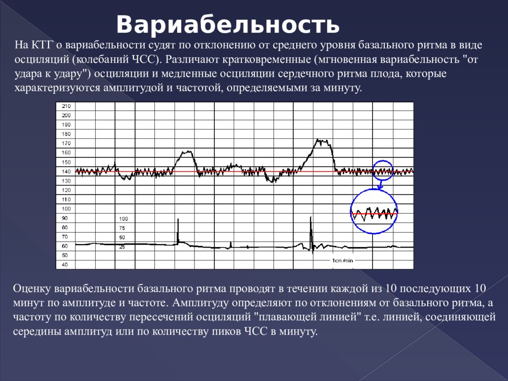 Осцилляция ктг