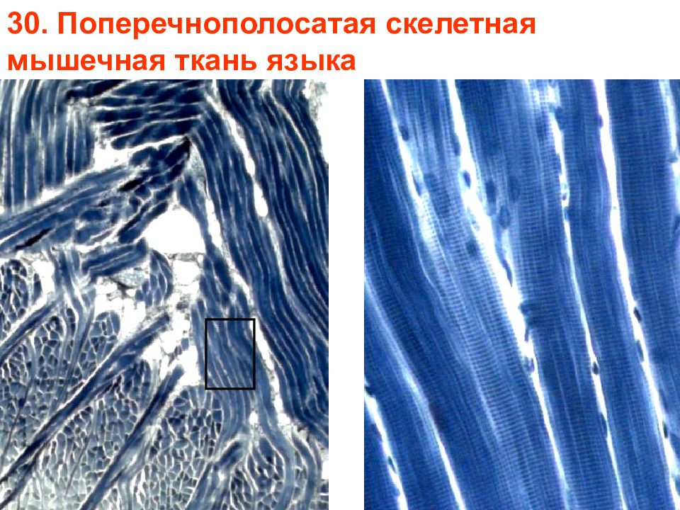 Поперечно полосатая мышечная ткань языка