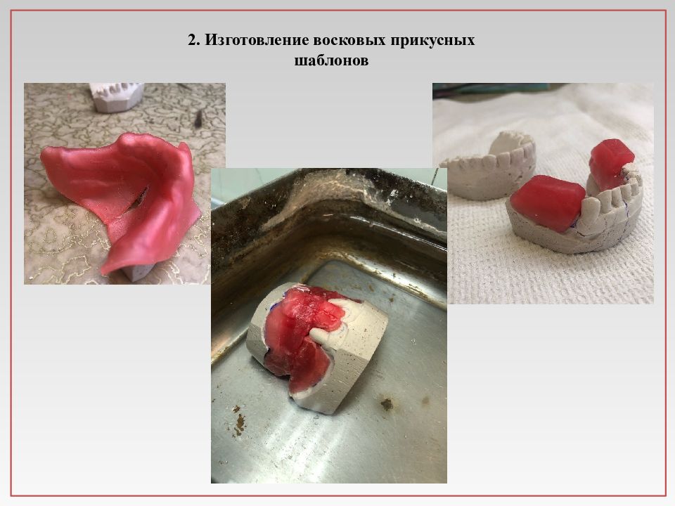 Изготовление восковых базисов. Изготовление прикусных восковых шаблонов. Прикусной воск. Изготовление восковых шаблонов с прикусными валиками. Прикусной шаблон.