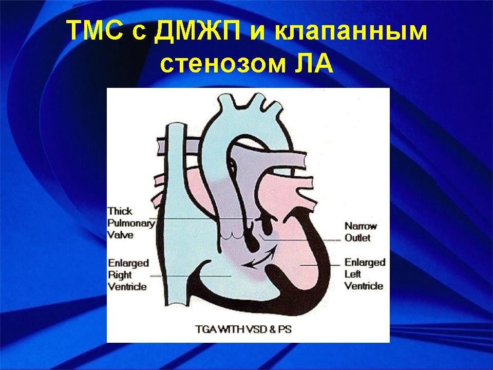 Анатомо физиологические особенности ссс презентация