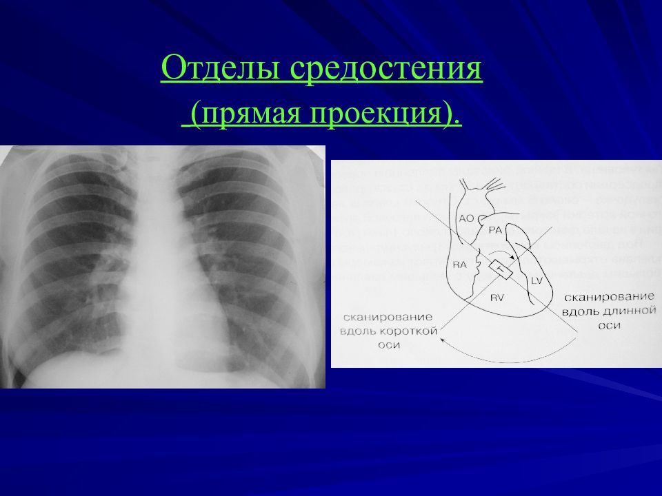 Лучевая диагностика органов средостения презентация