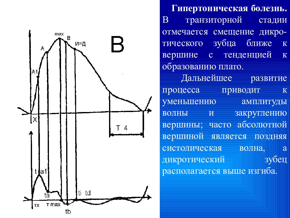 Уменьшить амплитуду. Физические основы импедансной реоплетизмографии. Гипертонический Тип РЭГ. .Физические основы реографии (импедансная плетизмография). Реография график.