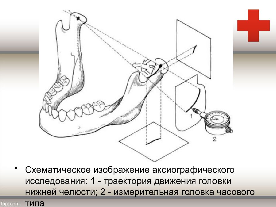 Функциональные методы диагностики в ортодонтии презентация