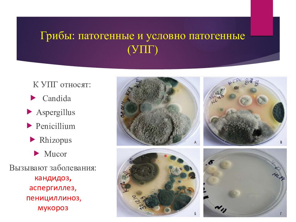 Аспергиллез микробиология презентация