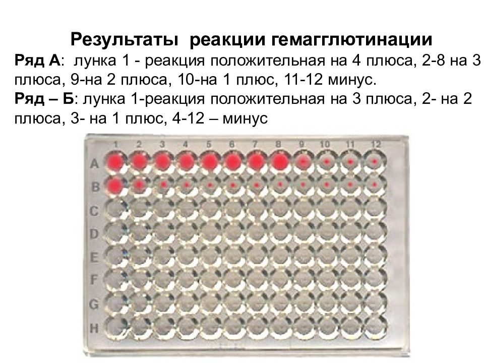 Реакция гемагглютинации. Реакция гемагглютинации положительная реакция. Реакция гемагглютинации в планшете. Реакция гемагглютинации Результаты. РТГА лунки.