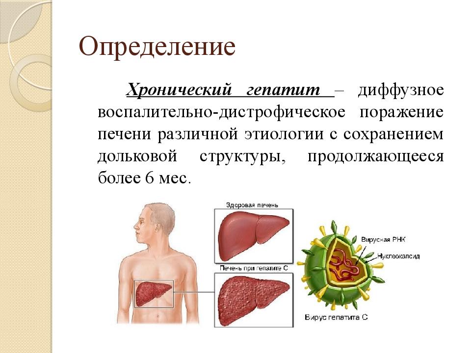 Хронический гепатит с презентация