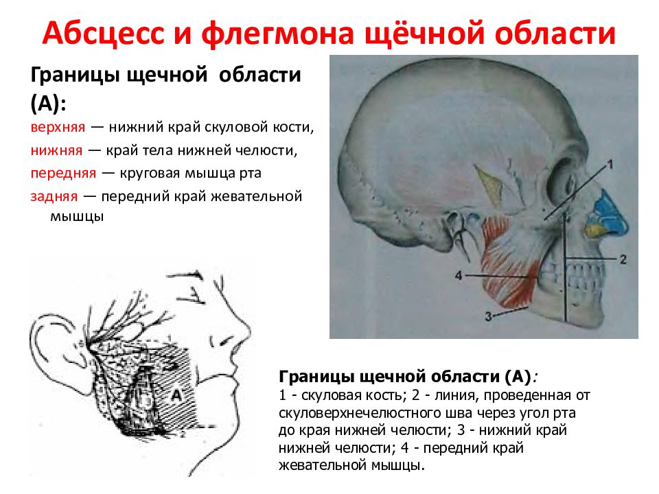 Границы флегмоны