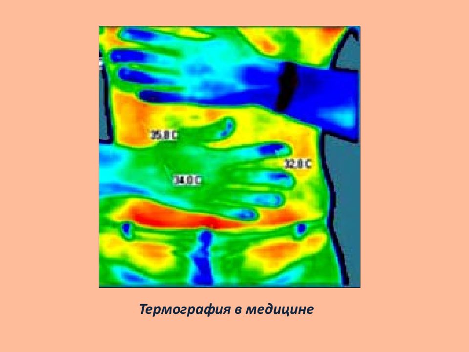 Характеристики теплового излучения термография презентация