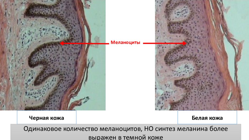 Пигмент меланин в каком слое. Меланоциты гистология. Меланоциты в коже гистология. Меланин клетка.