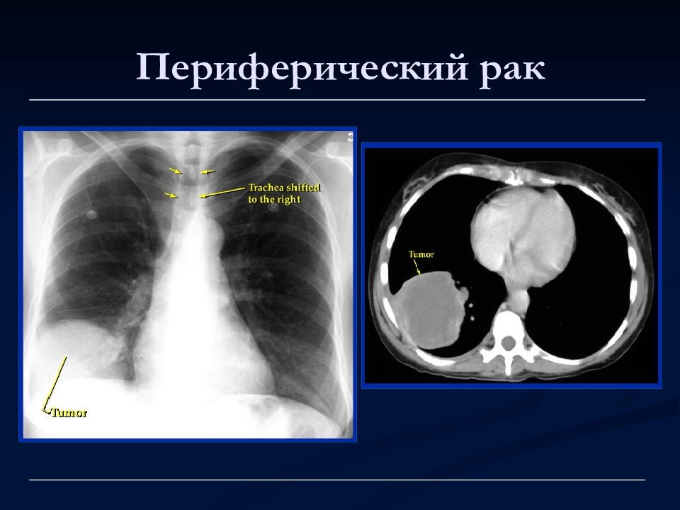 Лучевая диагностика органов дыхания презентация